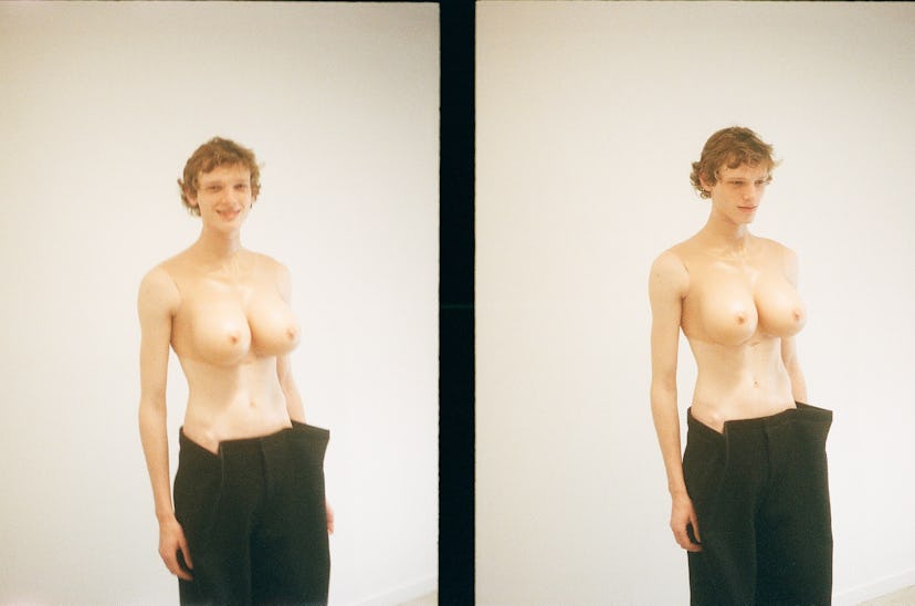 Model wears prosthetic breasts