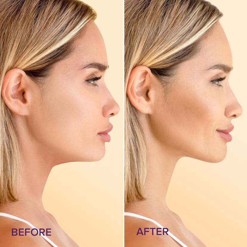 MAREE Collagen Chin Mask (5-Pack) 