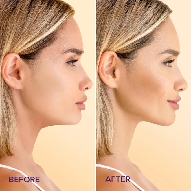 MAREE Collagen Chin Mask (5-Pack)