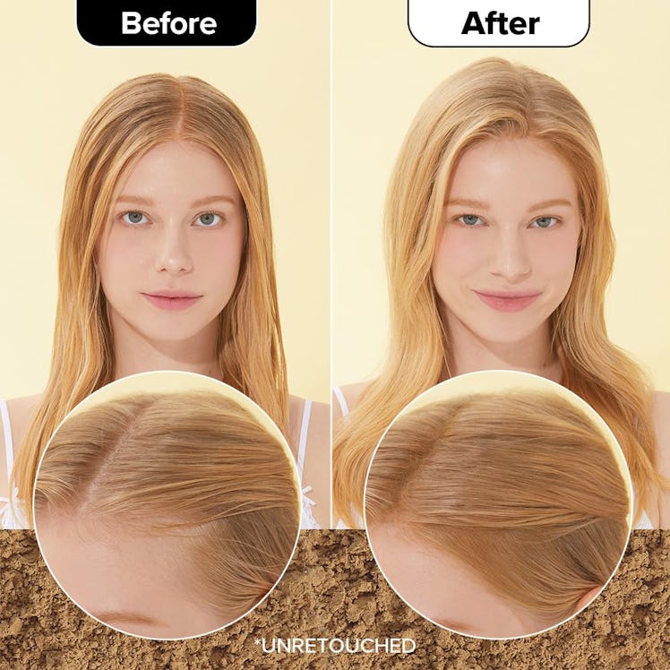 I DEW CARE Biotin Clarifying Dry Shampoo