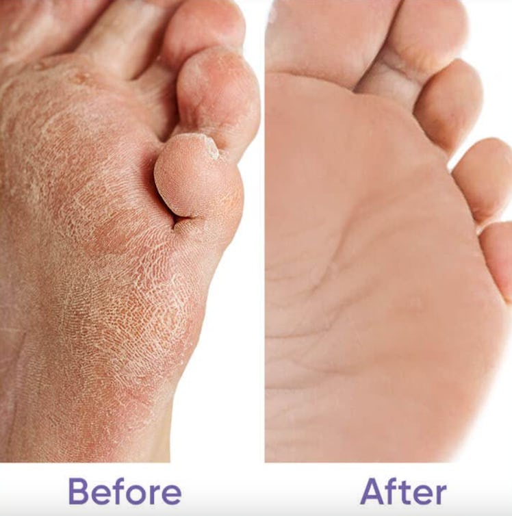 CÉLOR Foot Peel Mask (3 Pairs) 