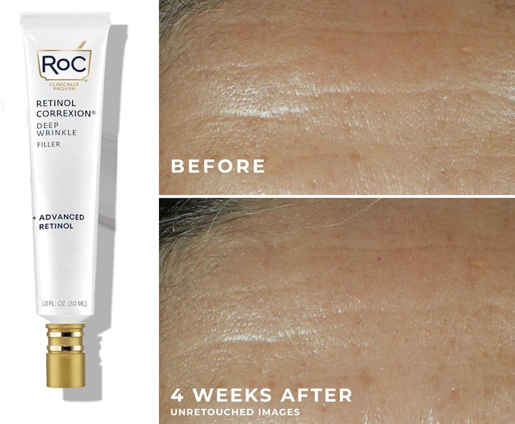 RoC Retinol Correxion Deep Wrinkle Filler, 1 oz