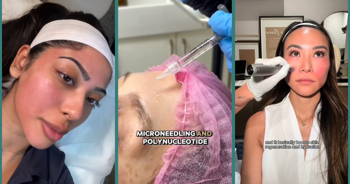 Do Salmon Sperm Facials Really Work? Skin Pros Weigh In