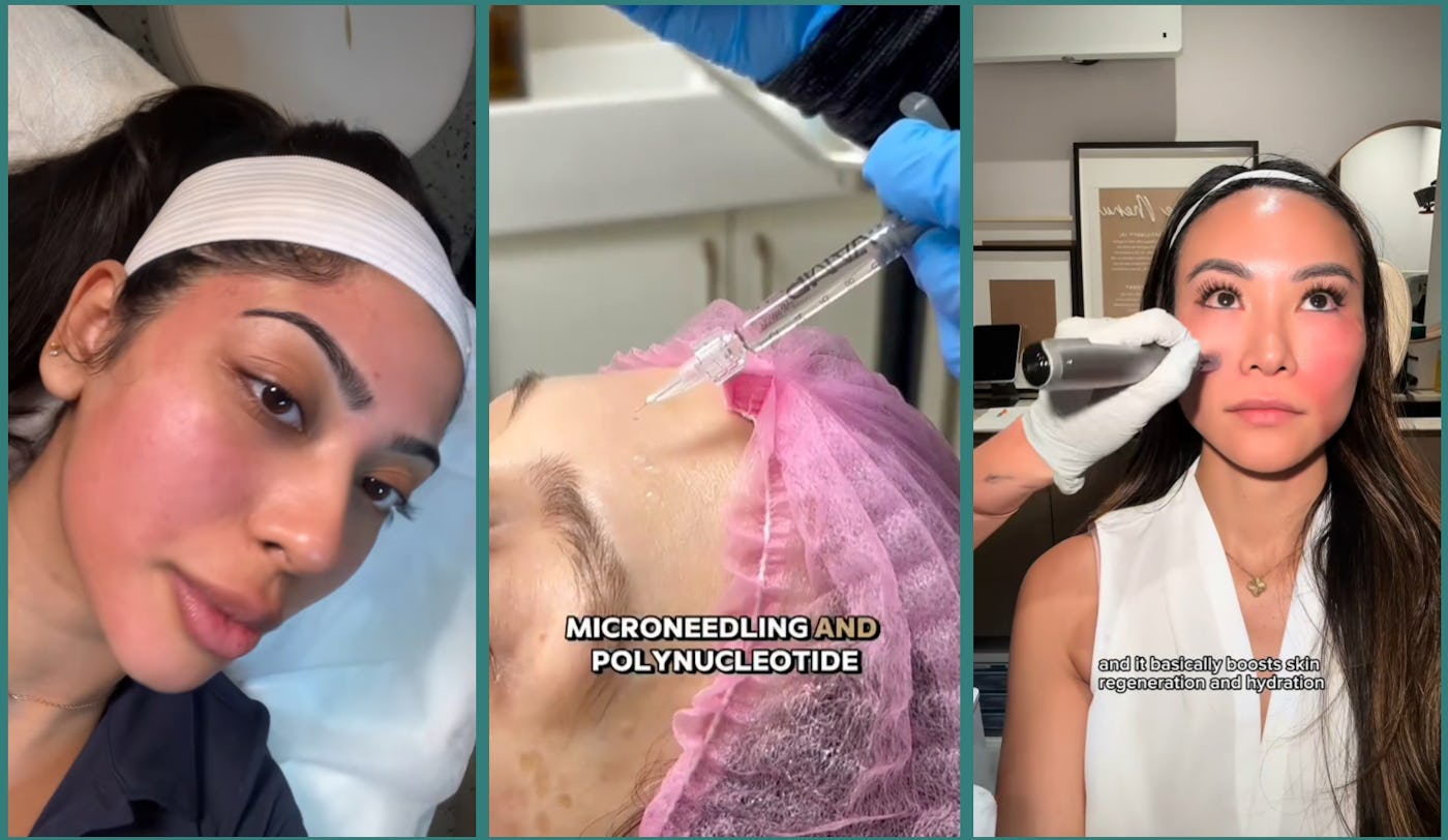 Do Salmon Sperm Facials Really Work? Skin Pros Weigh In