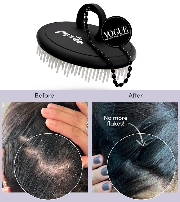 Jupiter Exfoliator Brush For Removing Dandruff & Build-Up