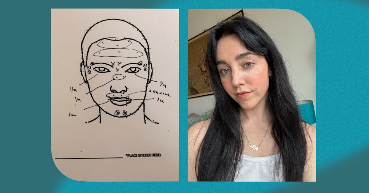 Does Jeuveau Really Last Longer Than Botox? I Tried It To Find Out