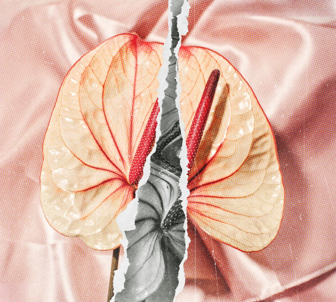 I Had A Hysterectomy, Felt Like A New Woman, Then Tore My Vagina. Twice.