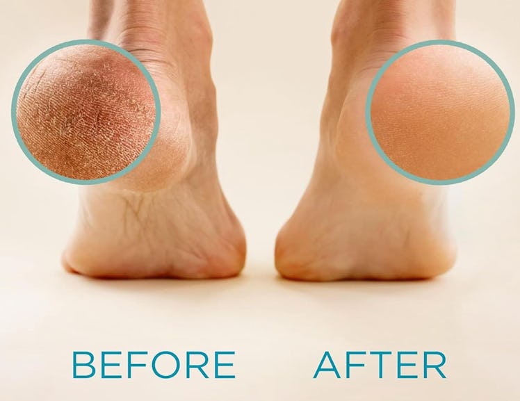 Lee Beauty Professional Callus Remover
