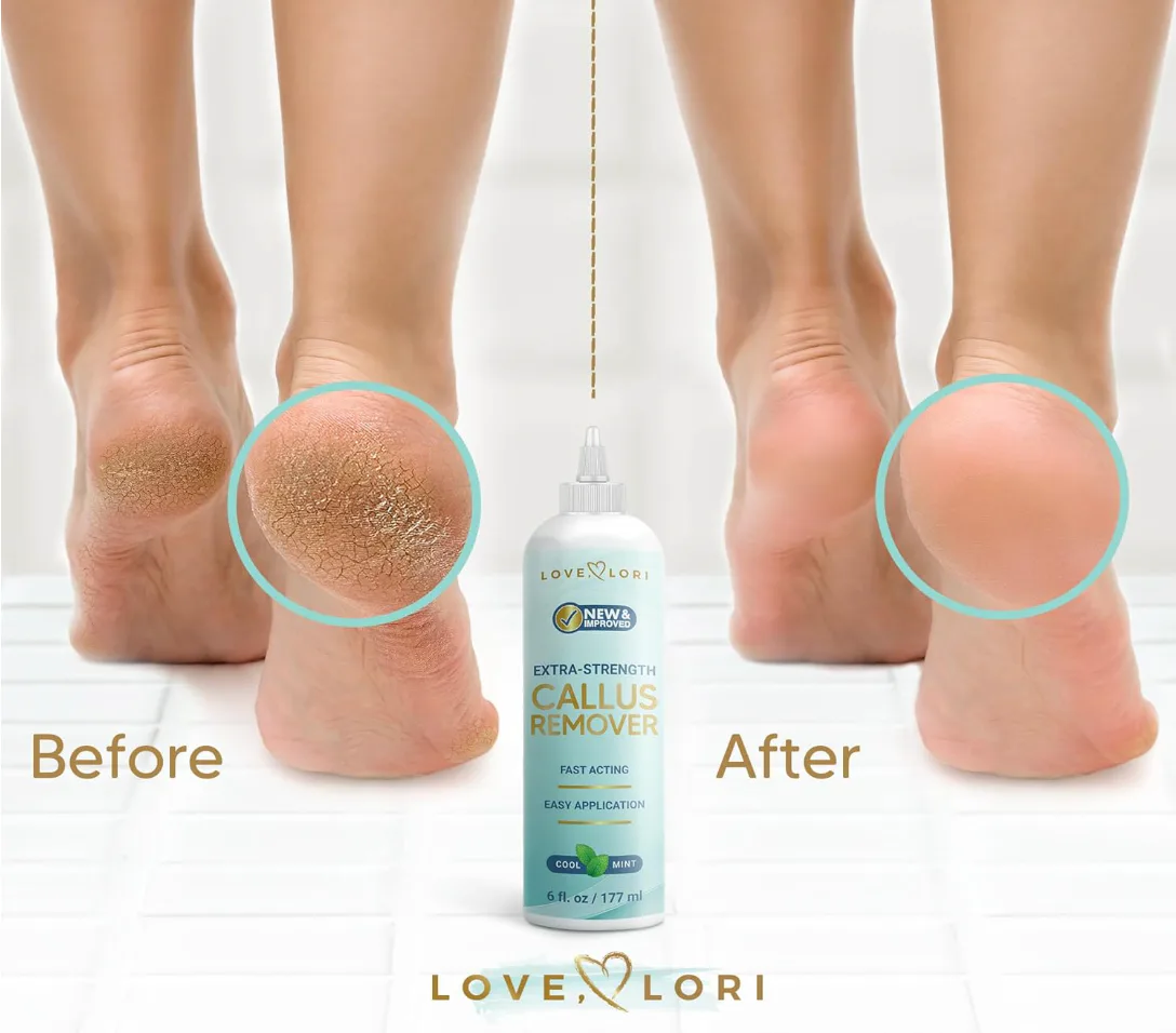 Love, Lori Foot Callus Remover