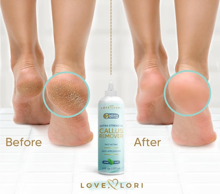 Love, Lori Foot Callus Remover