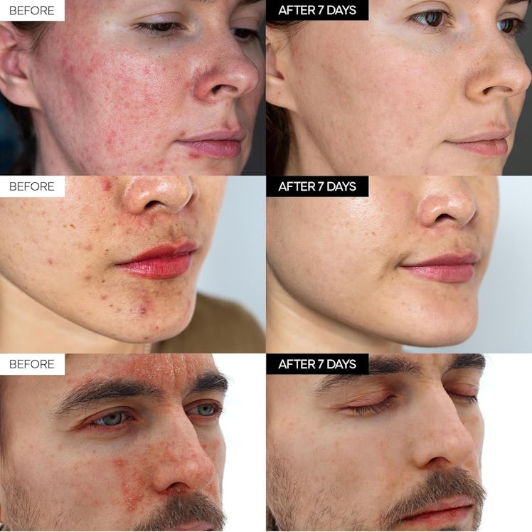 IVOSKIN Intensive Cica Repair Cream