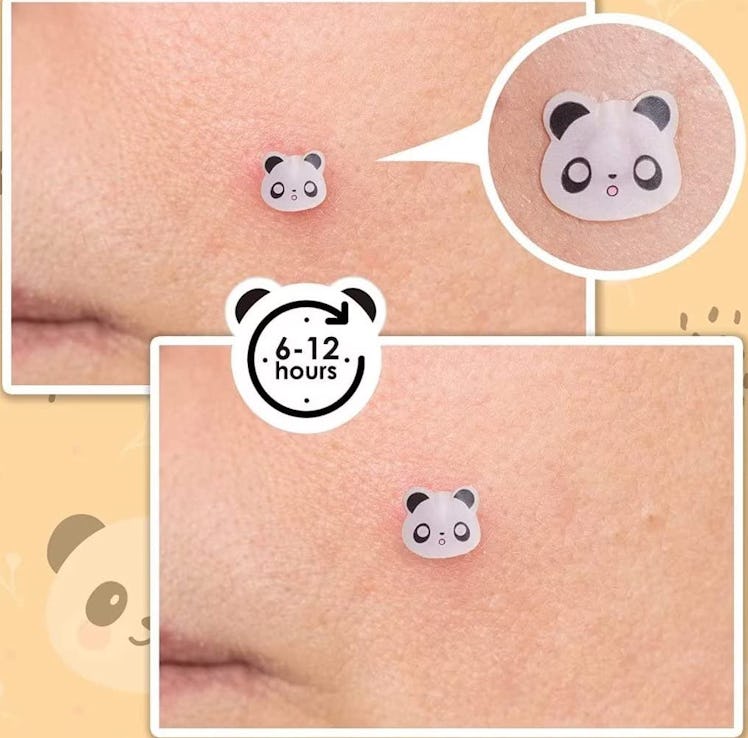  AUSLKA Panda Pimple Patches (120 Count)