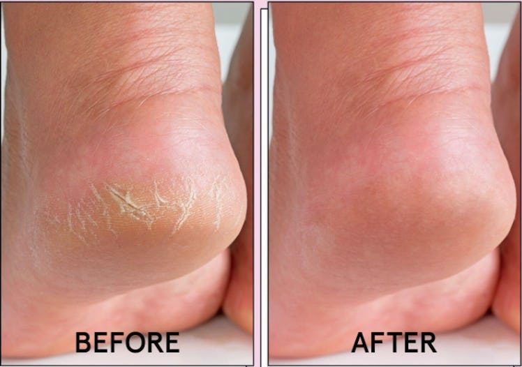 grace & stella Foot Peeling Masks (4 Pairs)