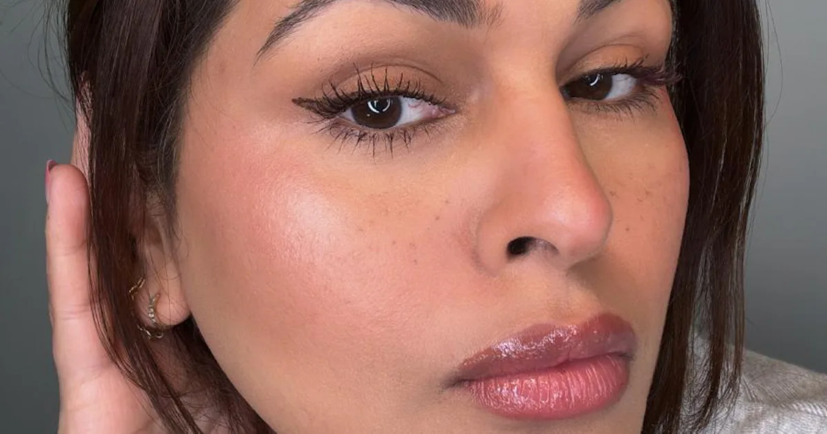 InMode's Forma Skin Tightening Treatment Gave Me A Snatched Jawline