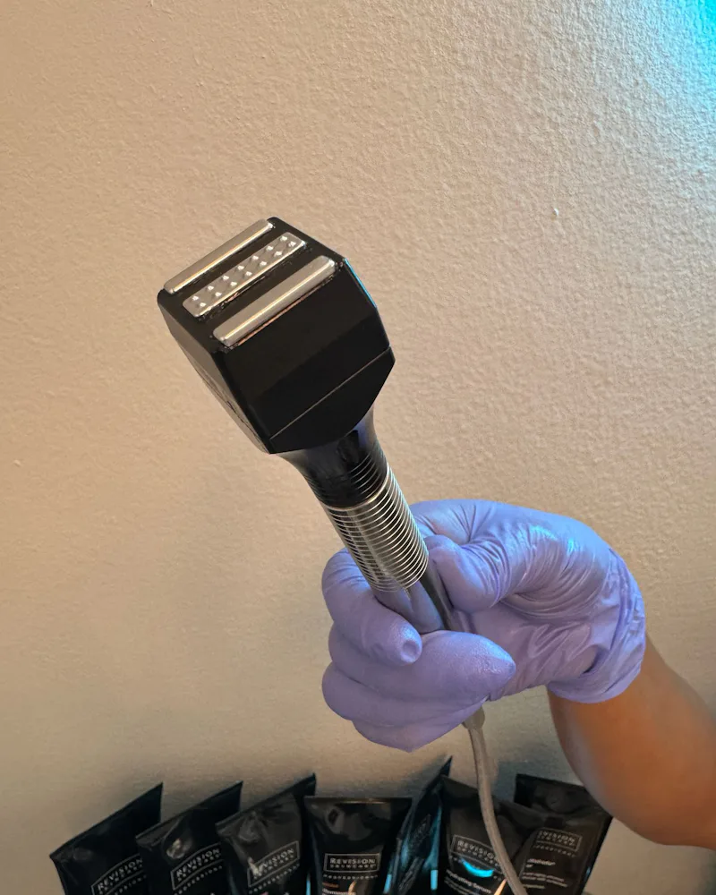 InMode's Forma Skin Tightening Treatment Gave Me A Snatched Jawline