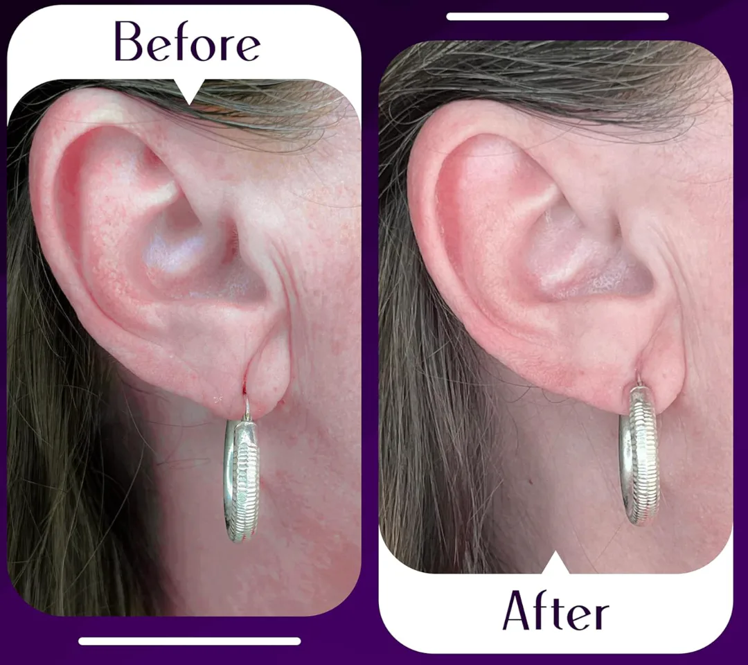 Lobe Wonder Ear Lobe Support Patches (60-Pack)