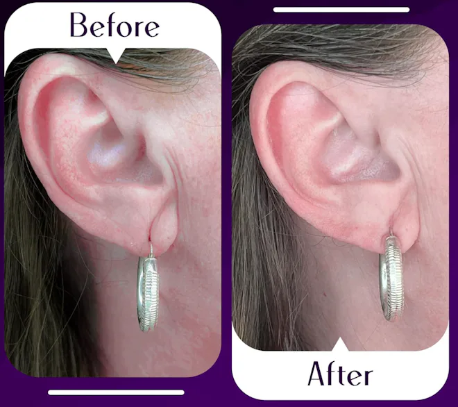 Lobe Wonder Ear Lobe Support Patches (60-Pack)