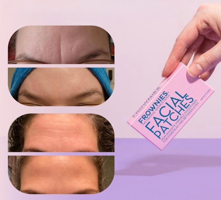 Frownies Forehead Facial Patches (144-Pack)