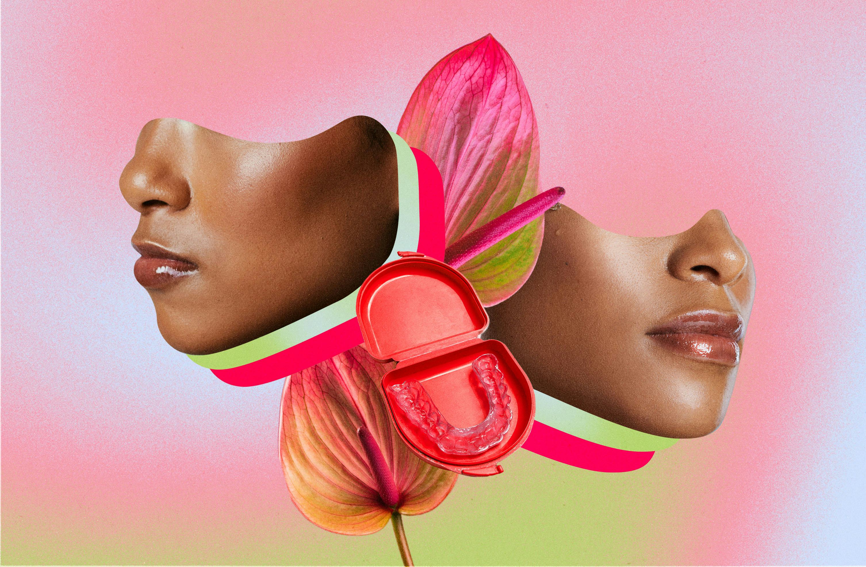 The unexpected beauty benefits of Invisalign.