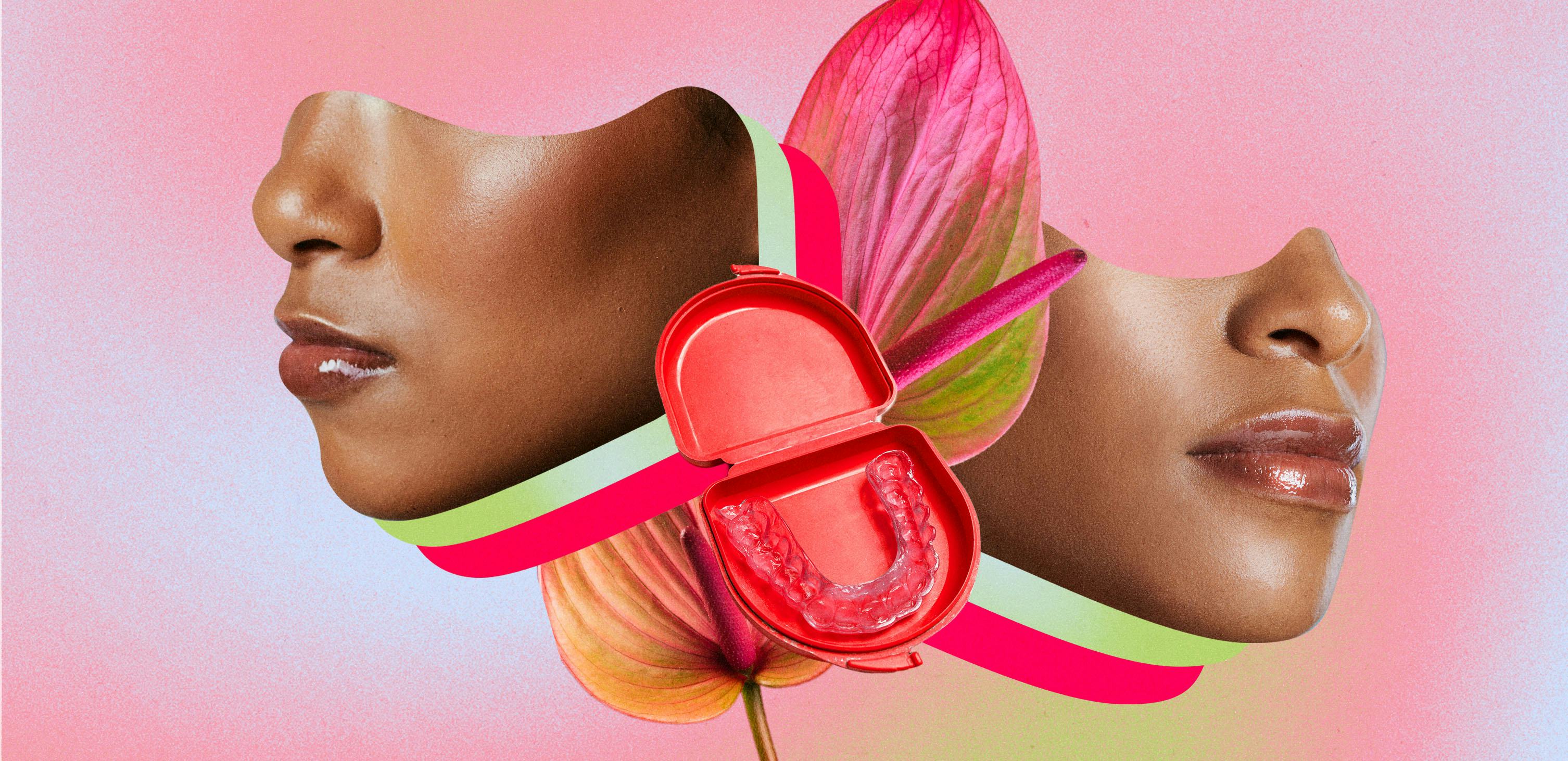 I Got Invisalign. I Didn't Expect A Total Face Glow-Up.