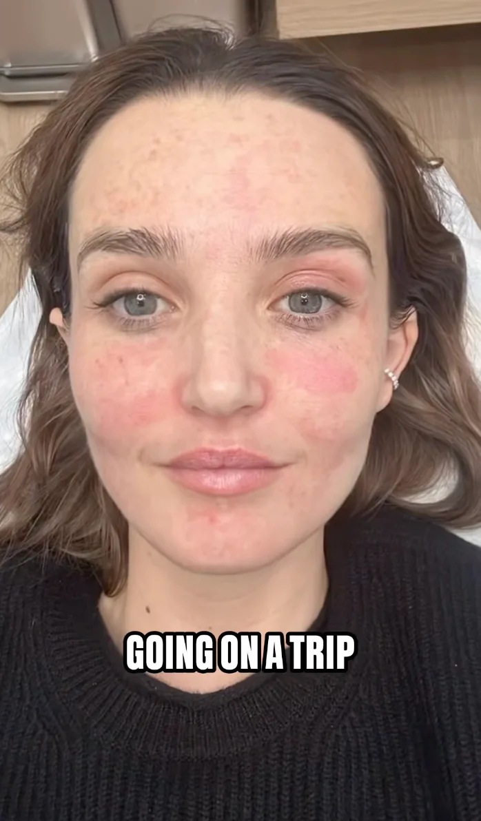 Chloe Fineman posts "botched" cosmetic selfies. Screenshot via TikTok