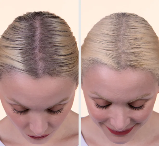 BOLDIFY Hairline Powder