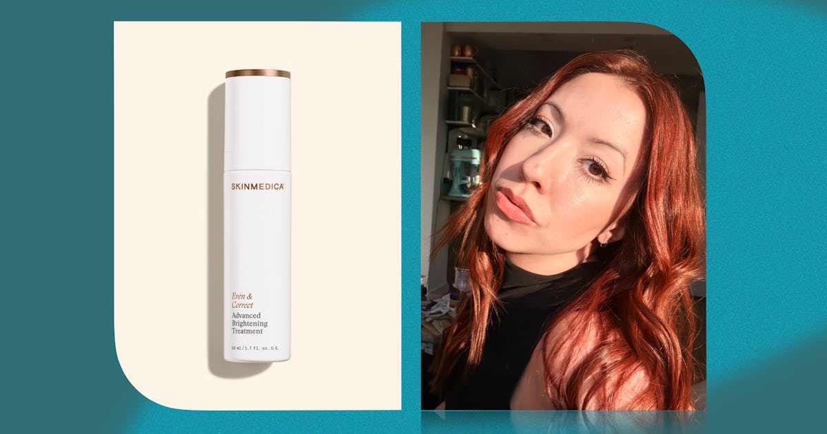 This Under-The-Radar Ingredient Zapped My Stubborn Post-Acne Marks