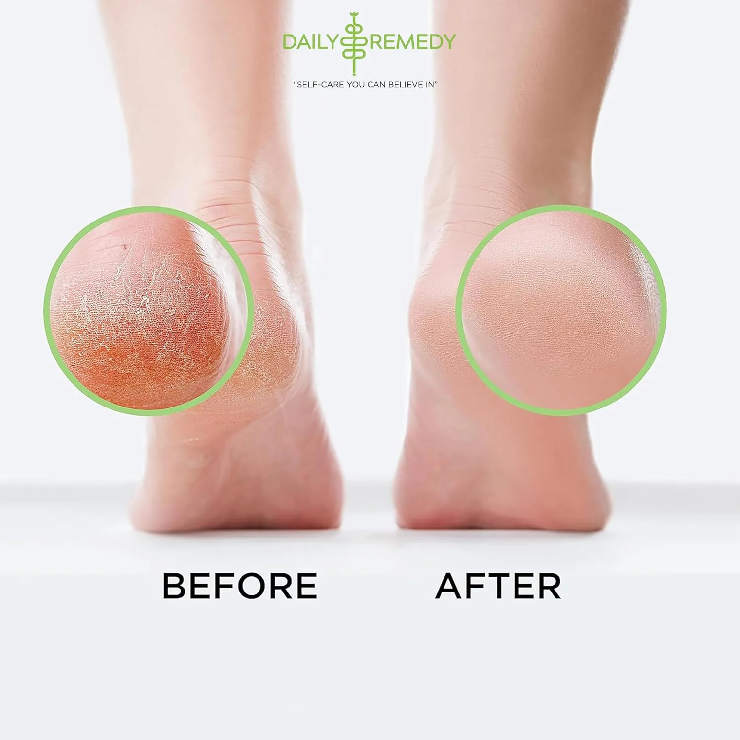 DAILY REMEDY Tea Tree Oil Foot Soak