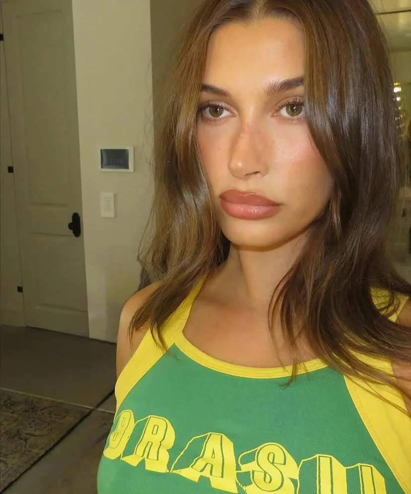 fawn freckles