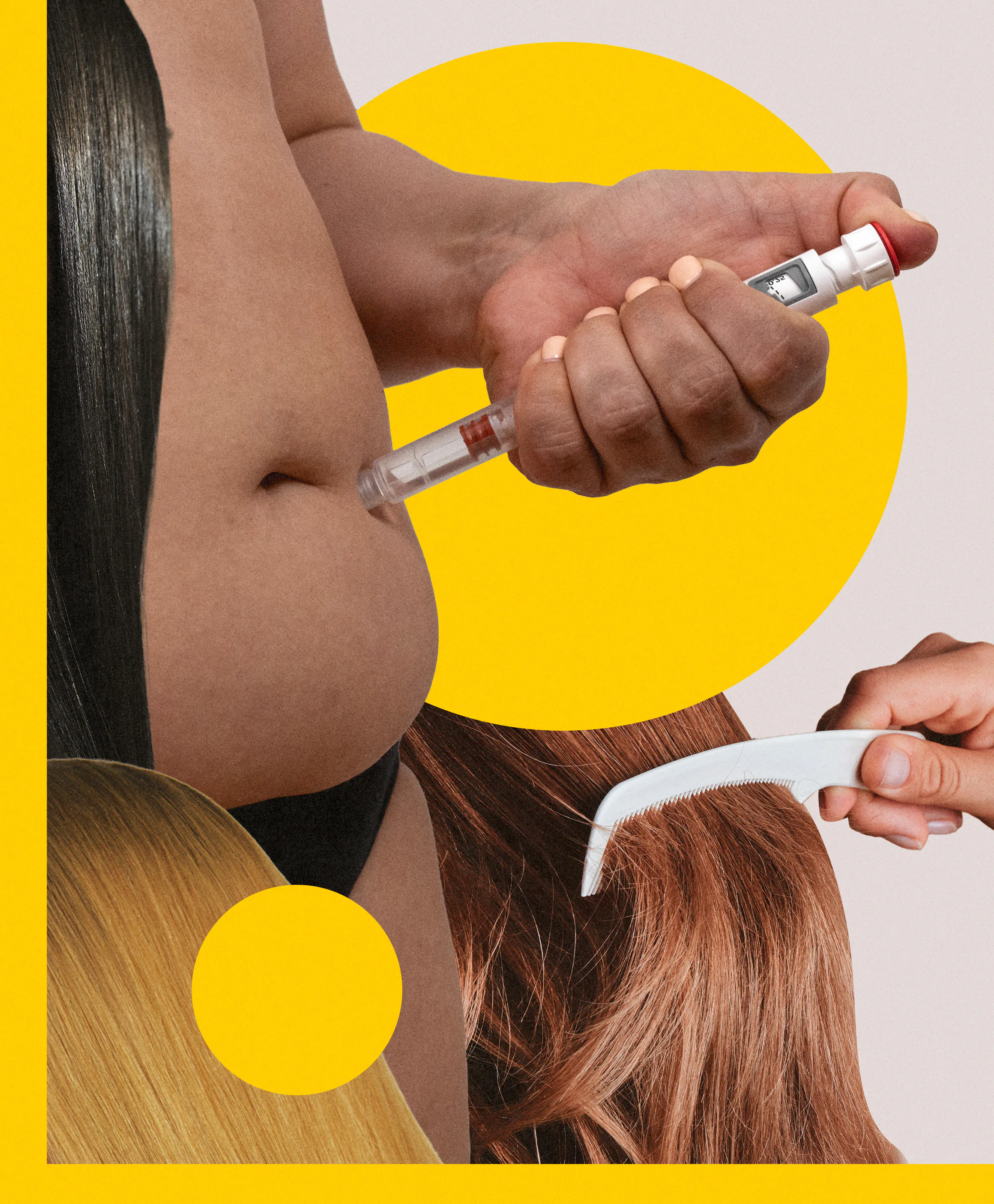 Do GLP-1s Cause Hair Loss? 