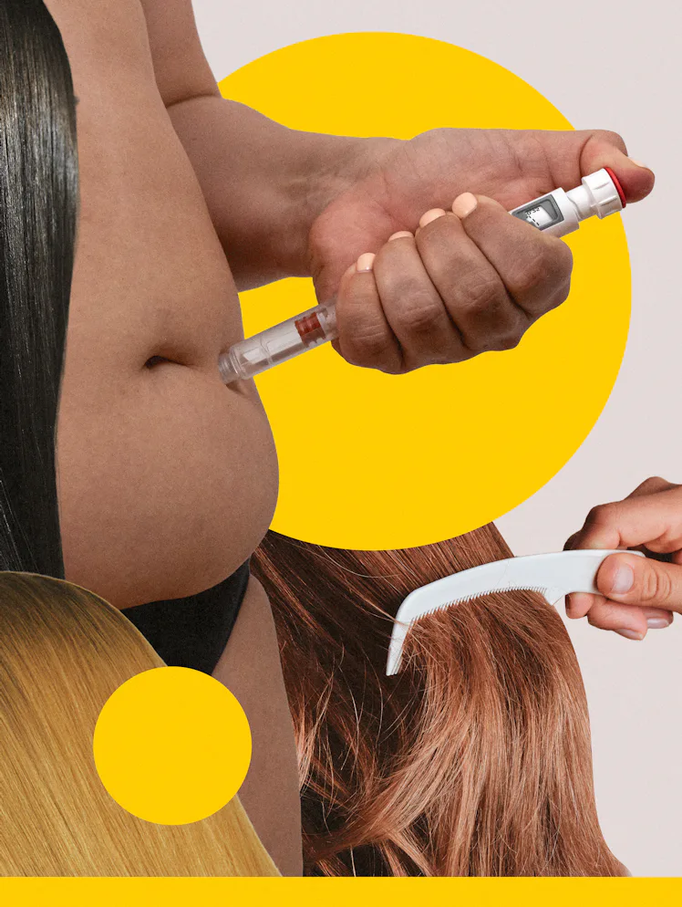 Do GLP-1s Cause Hair Loss?