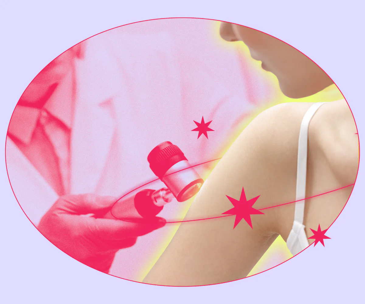 Facts About Hidradenitis Suppurativa That Derms Wish More Young Women Knew
