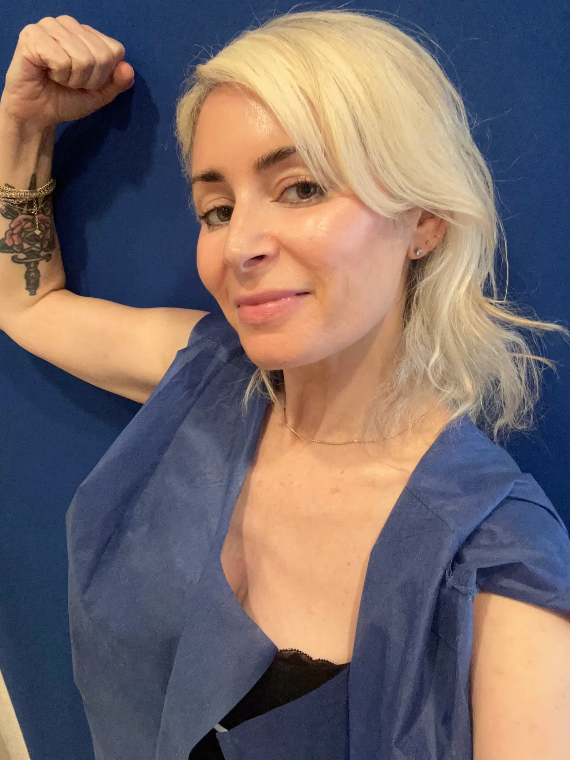 Ultherapy Prime for arms