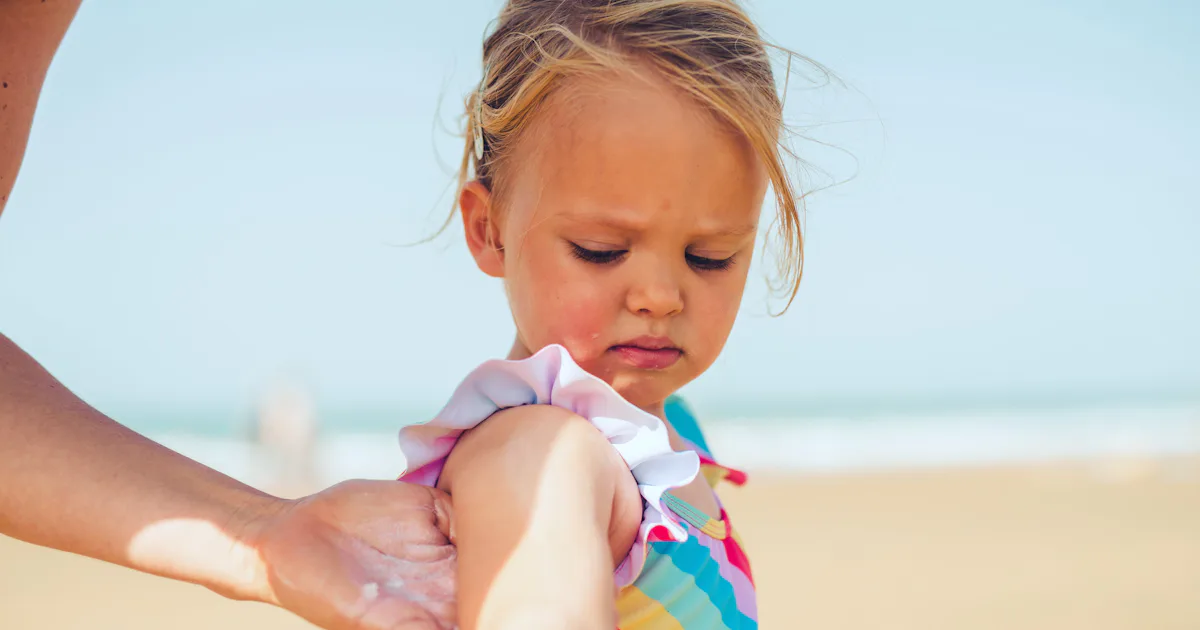 Nothing Says #BadMom Like A Kid With A Sunburn