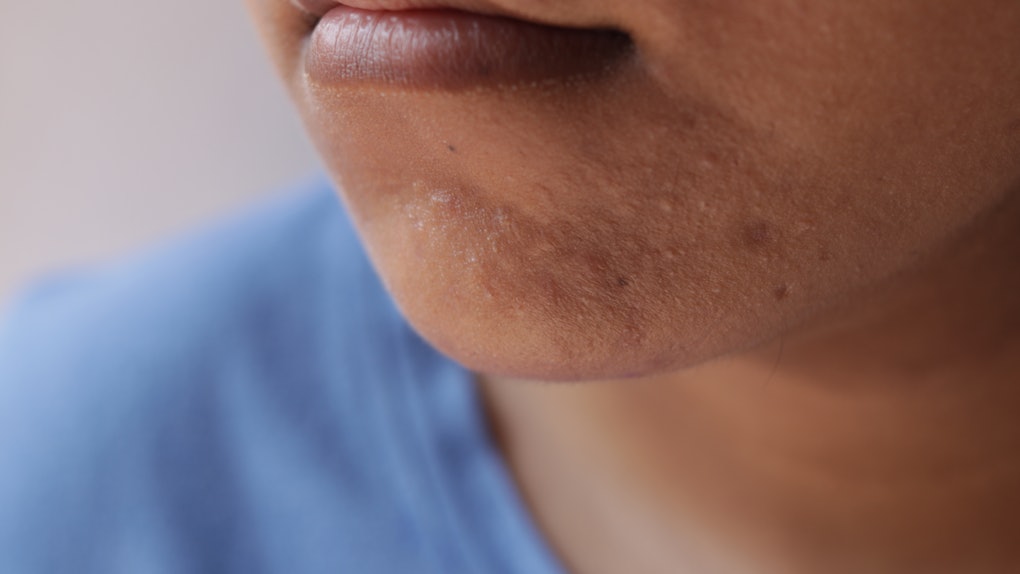 Reasons Why Some Men Can T Grow Beards Even If Their Lives