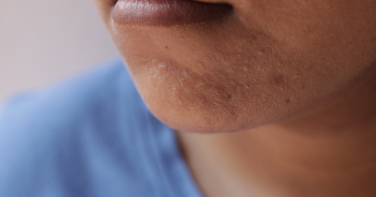 Reasons Why Some People Can't Grow Beards Even If Their Lives Depended On It Reasons Why Some People Can't Grow Beards Even If Their Lives Depended On It