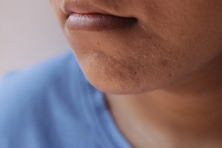 man with no beard, why people can't grow beards sometimes