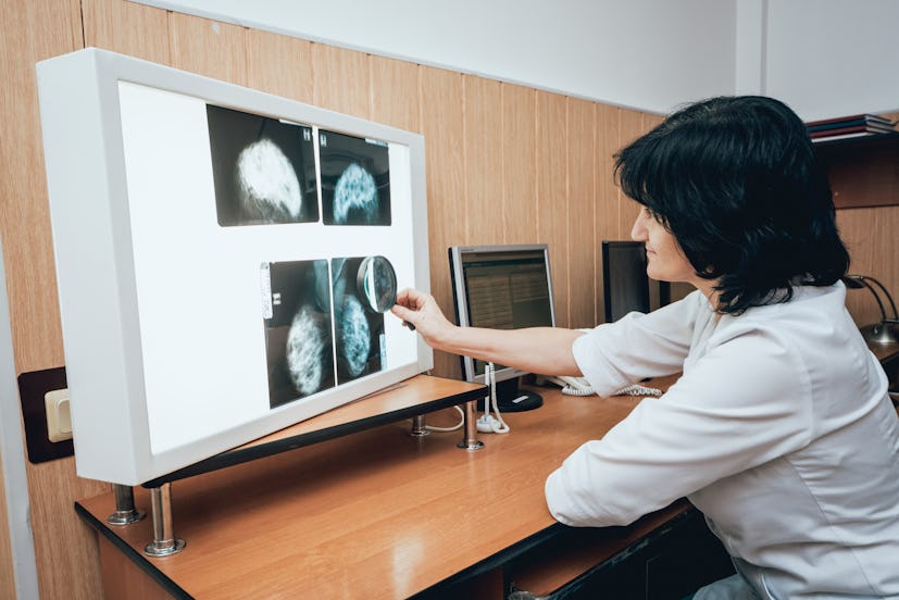 Doctor examine mammography test. Medical equipment at the hospital. Background