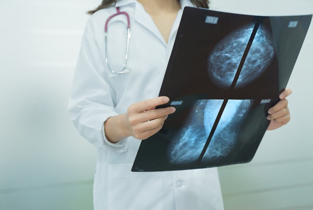 Regular mammograms may help early detection of breast cancers.