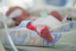 a premature baby in Neonatal Intensive Care