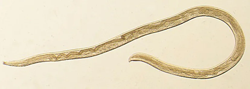 Roundworm Eye Parasitic roundworms infect human eyes, confusing scientists