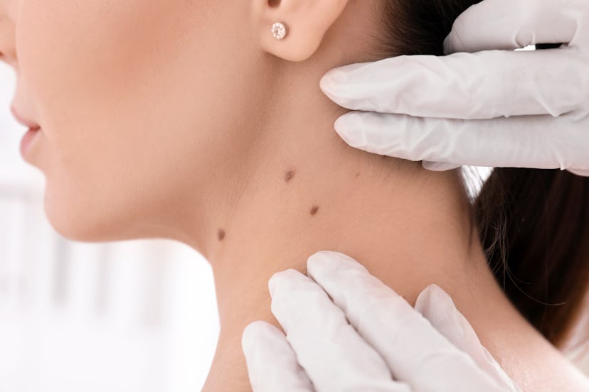 Dermatologist examining patient in clinic, closeup view