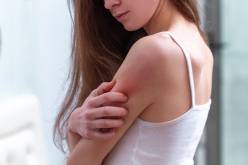 Young woman suffering from itching on her skin and scratching an itchy place. Allergic reaction to i...