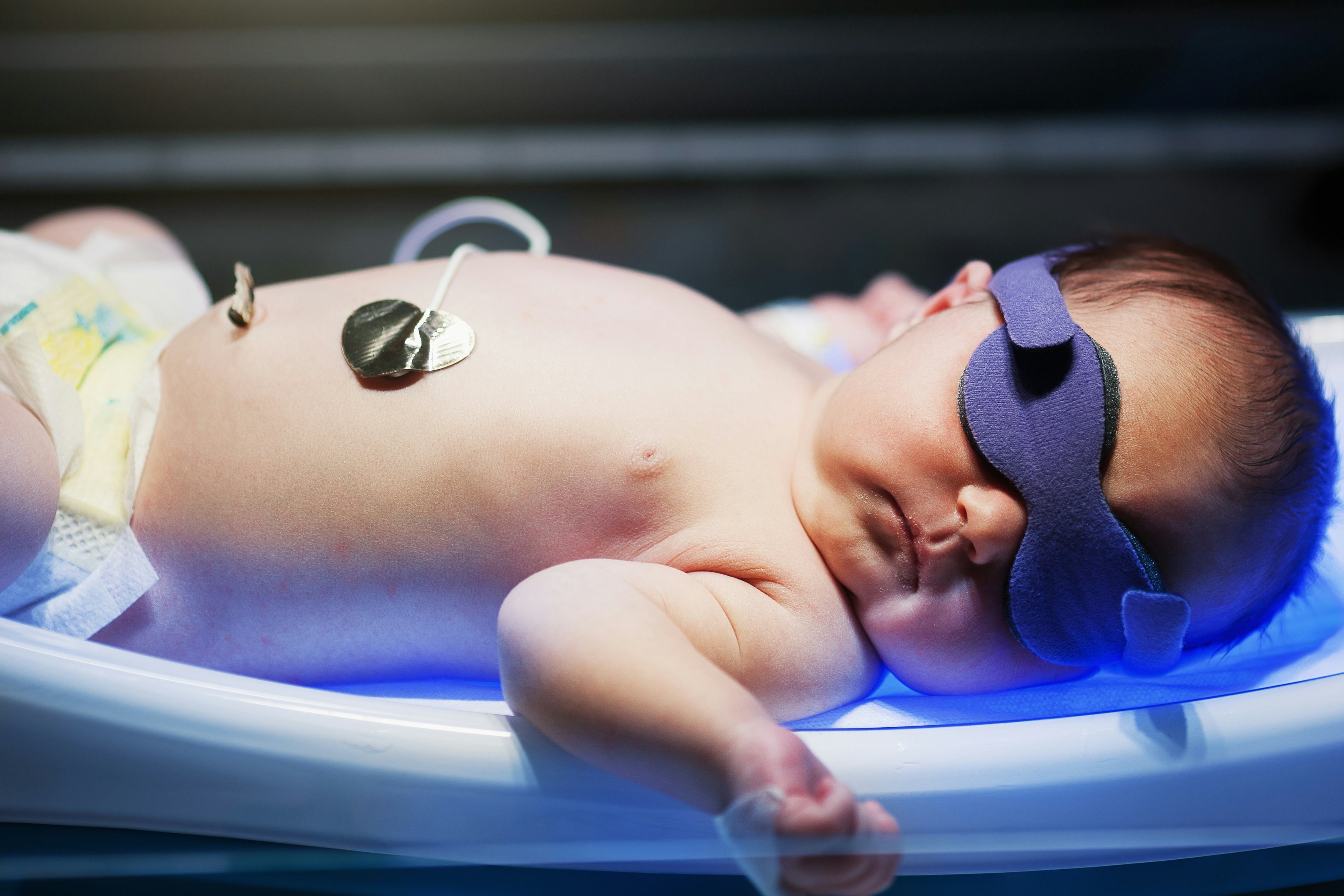 How Long Does Jaundice Last? Not Every Baby Has To Stay Under The Lights