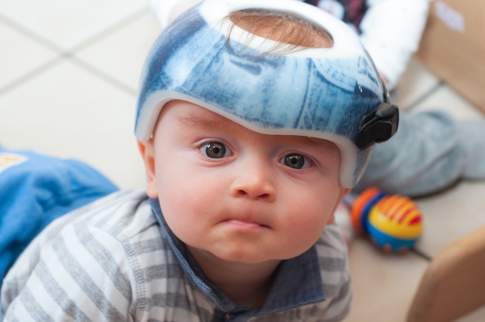 Does My Baby Need A Helmet Plagiocephaly Is More Common Than You Think