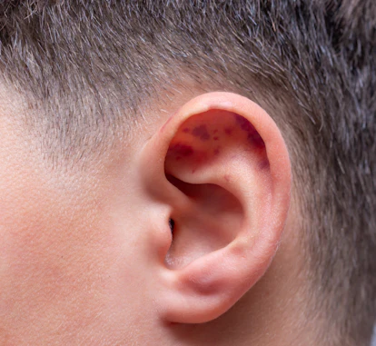 10 Unexpected Signs Bruising Is Part Of A Larger Health Condition