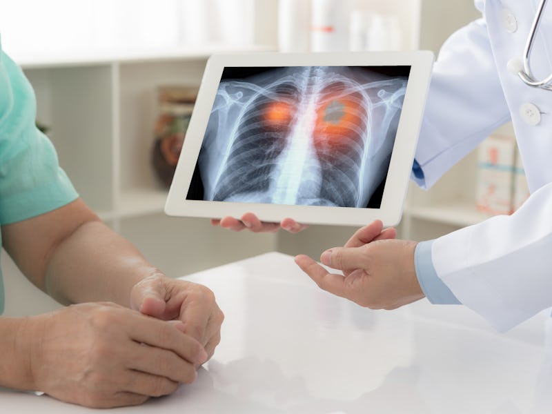 lung cancer concept. doctor explaining results of lung check up from x-ray scan chest on digital tab...