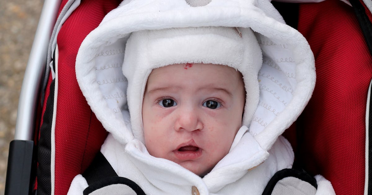Can You See A Cleft Palate On An Ultrasound? Here's What The Experts Say Can You See A Cleft Palate On An Ultrasound? Here's What The Experts Say