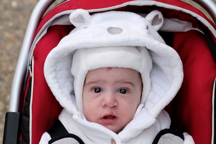 Baby with cleft lip