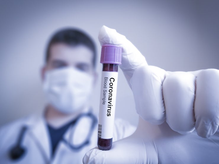 Coronavirus 2019-nCoV Blood Sample. Corona virus outbreaking. Epidemic virus Respiratory Syndrome. C...